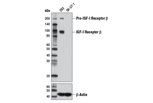 Western Blotting Image 1: IGF-I Receptor β (D23H3) XP® Rabbit mAb