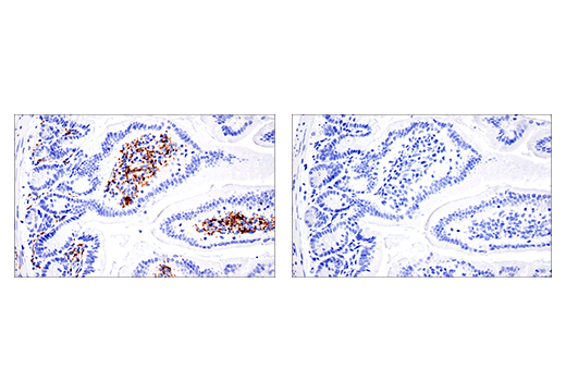  Image 80: Mouse Reactive M1 vs M2 Macrophage IHC Antibody Sampler Kit