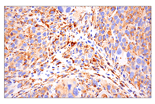  Image 65: Mouse Reactive M1 vs M2 Macrophage IHC Antibody Sampler Kit