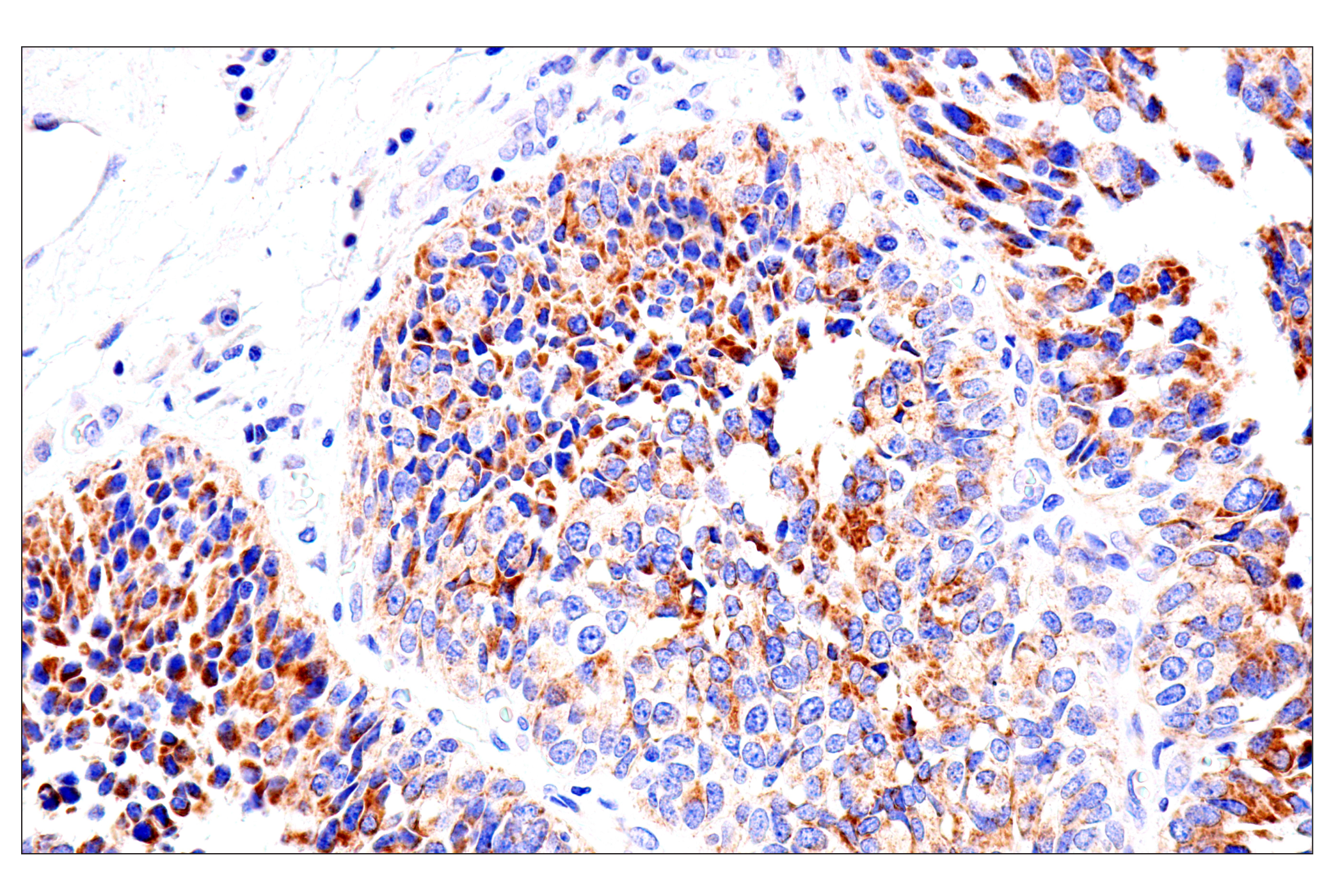 Immunohistochemistry Image 8: SLC25A1 (E7B2B) Rabbit mAb