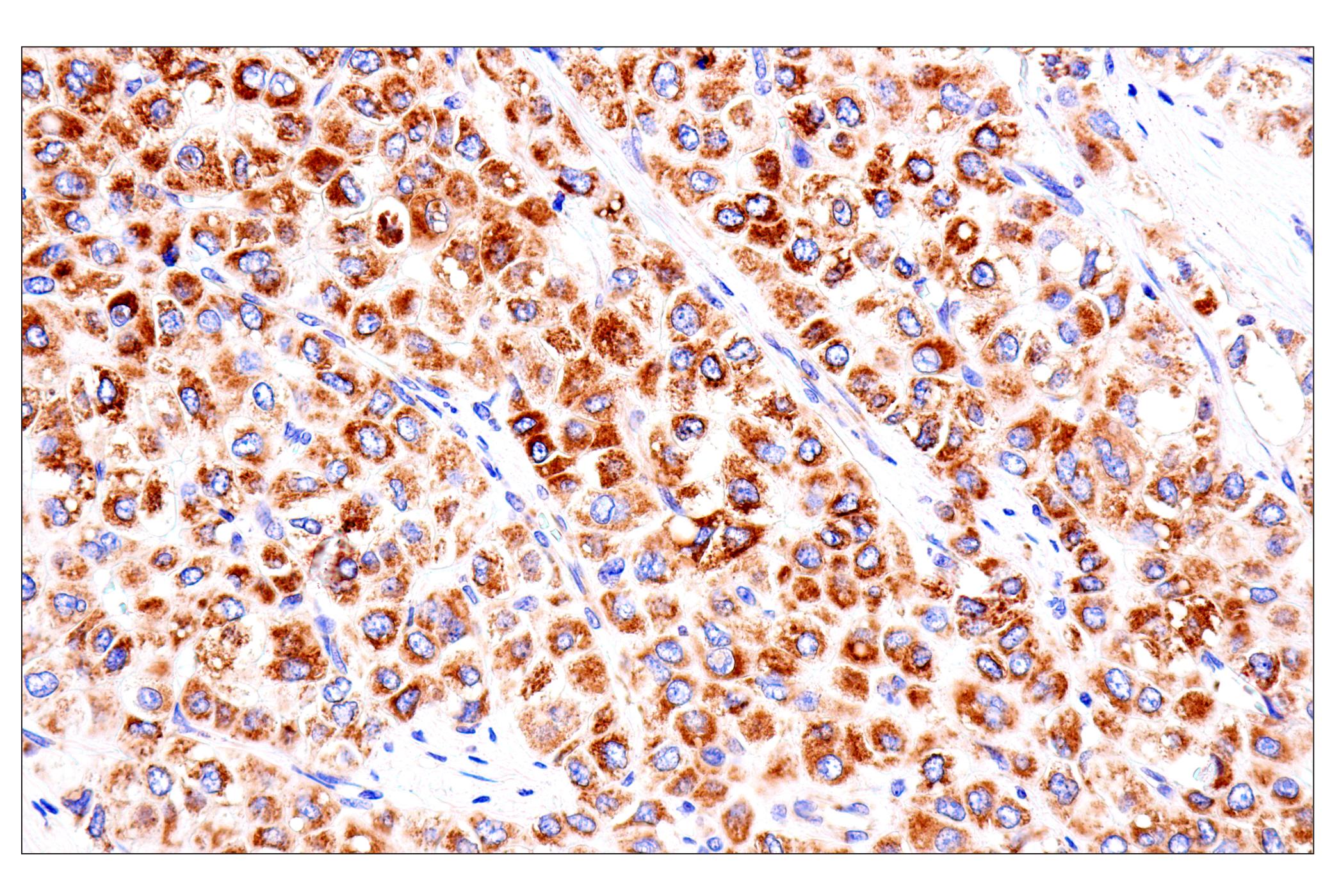 Immunohistochemistry Image 4: SLC25A1 (E7B2B) Rabbit mAb