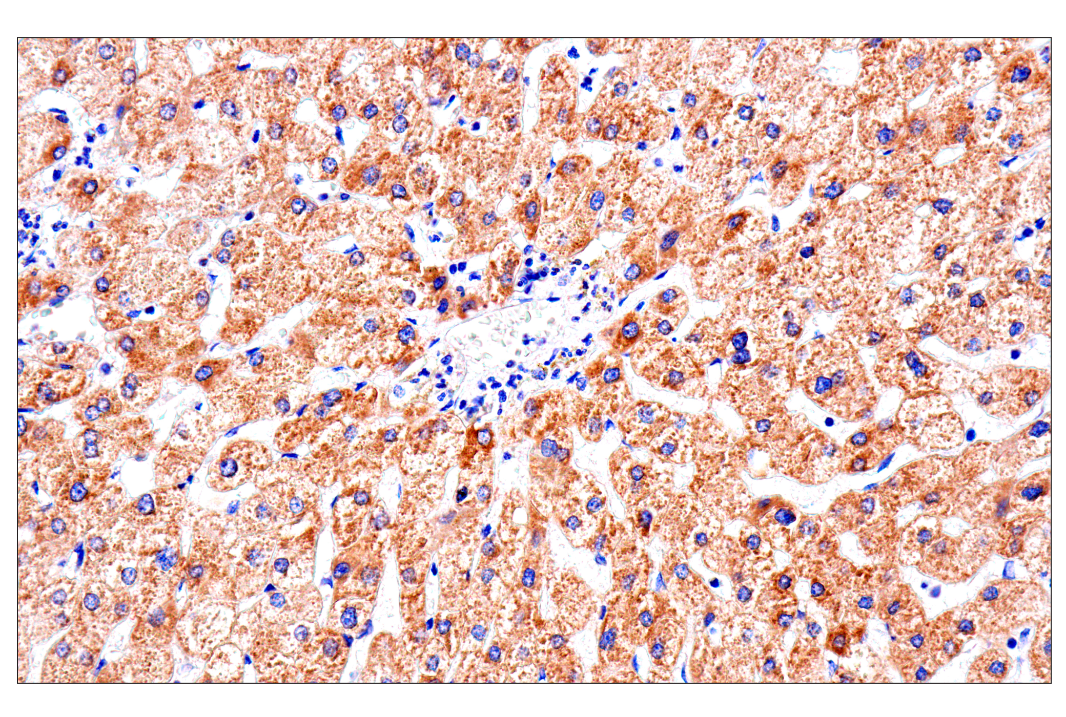 Immunohistochemistry Image 13: SLC25A1 (E7B2B) Rabbit mAb