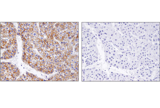 Immunohistochemistry Image 1: Flotillin-1 (D2V7J) XP® Rabbit mAb (BSA and Azide Free)