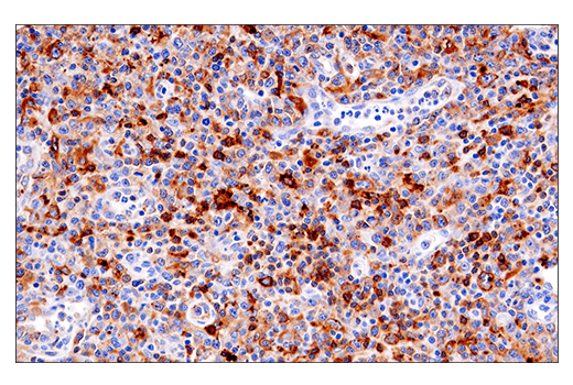  Image 62: Human Reactive M1 vs M2 Macrophage IHC Antibody Sampler Kit