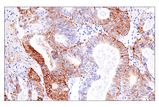  Image 65: Human Reactive M1 vs M2 Macrophage IHC Antibody Sampler Kit