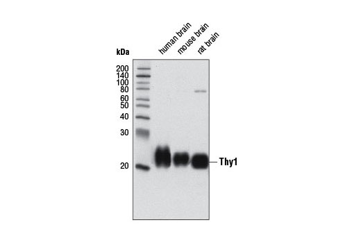 Western Blotting Image 1: Thy1 Antibody