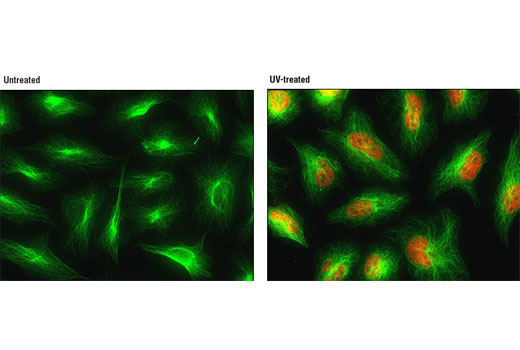 Immunofluorescence Image 1: Phospho-p38 MAPK (Thr180/Tyr182) (D3F9) XP® Rabbit mAb (Alexa Fluor® 555 Conjugate)