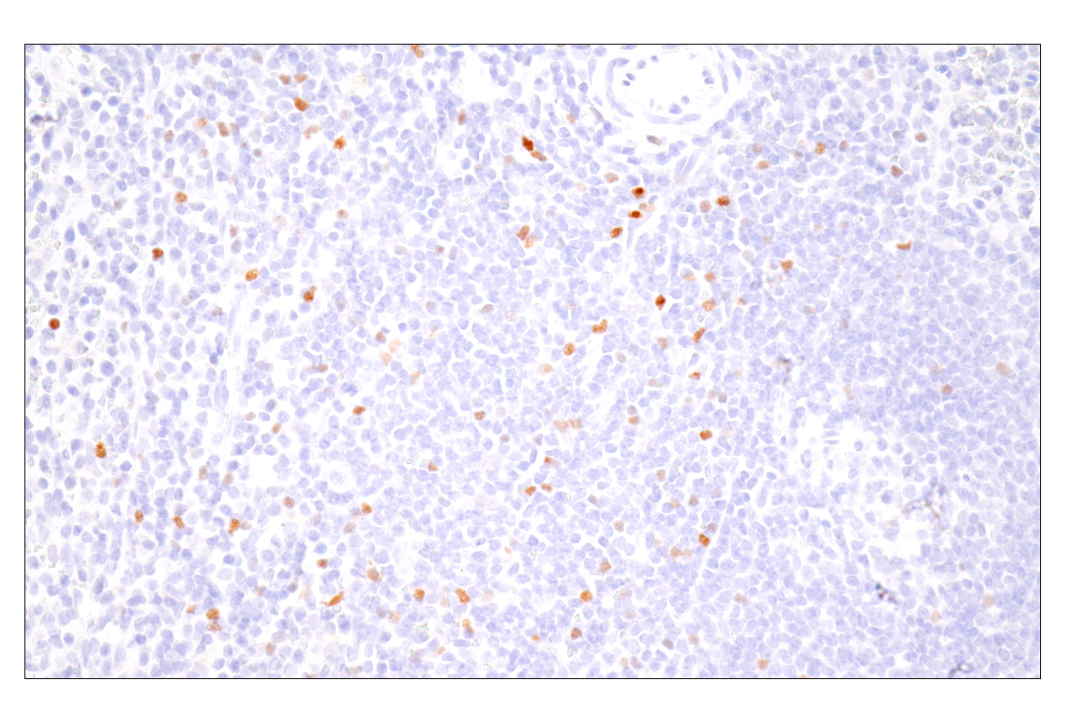 Immunohistochemistry Image 4: FoxP3 (D2W8E™) Rabbit mAb