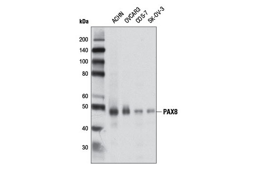 Western Blotting Image 1: PAX8 Antibody