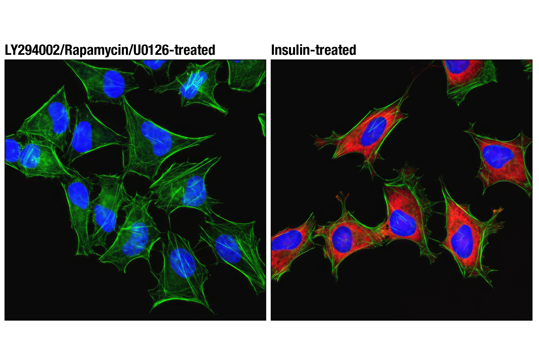 Immunofluorescence Image 1: Phospho-S6 Ribosomal Protein (Ser235/236) (D57.2.2E) XP® Rabbit mAb (Alexa Fluor® 594 Conjugate)