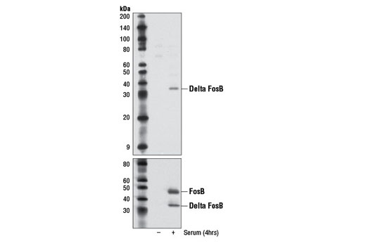 Western Blotting Image 1: Delta FosB Antibody