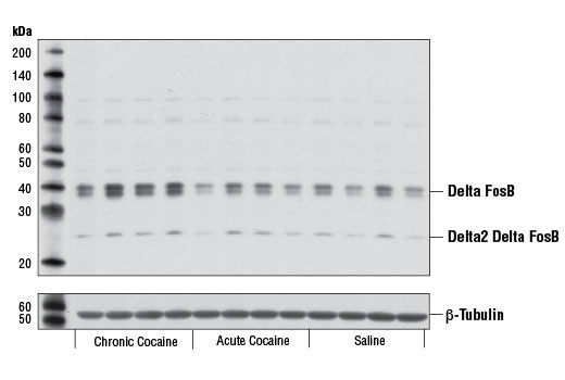 Western Blotting Image 2: Delta FosB Antibody