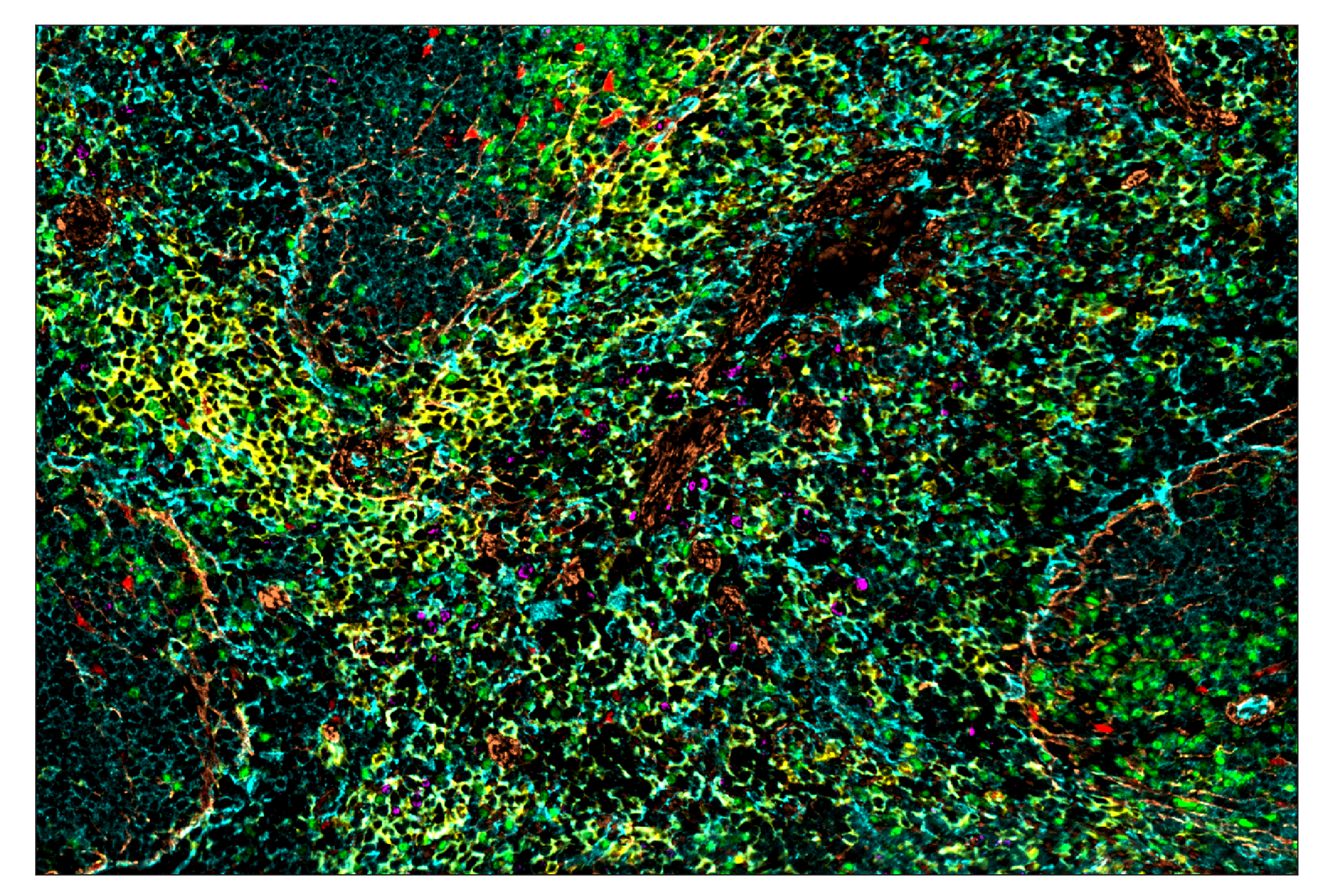 Immunohistochemistry Image 1: CD31 (PECAM-1) (D8V9E) & CO-0050-647 SignalStar™ Oligo-Antibody Pair