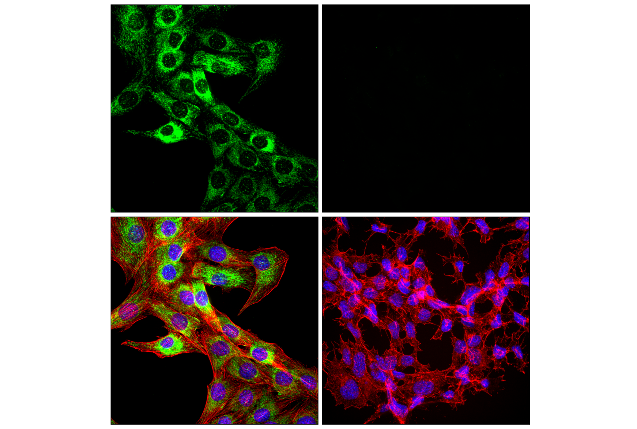 Immunofluorescence Image 2: TSPO (F5B8F) Rabbit mAb