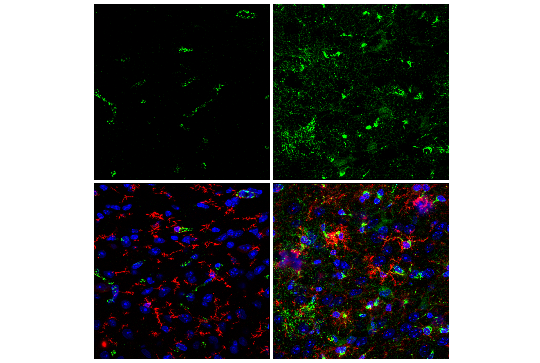 Immunofluorescence Image 1: TSPO (F5B8F) Rabbit mAb