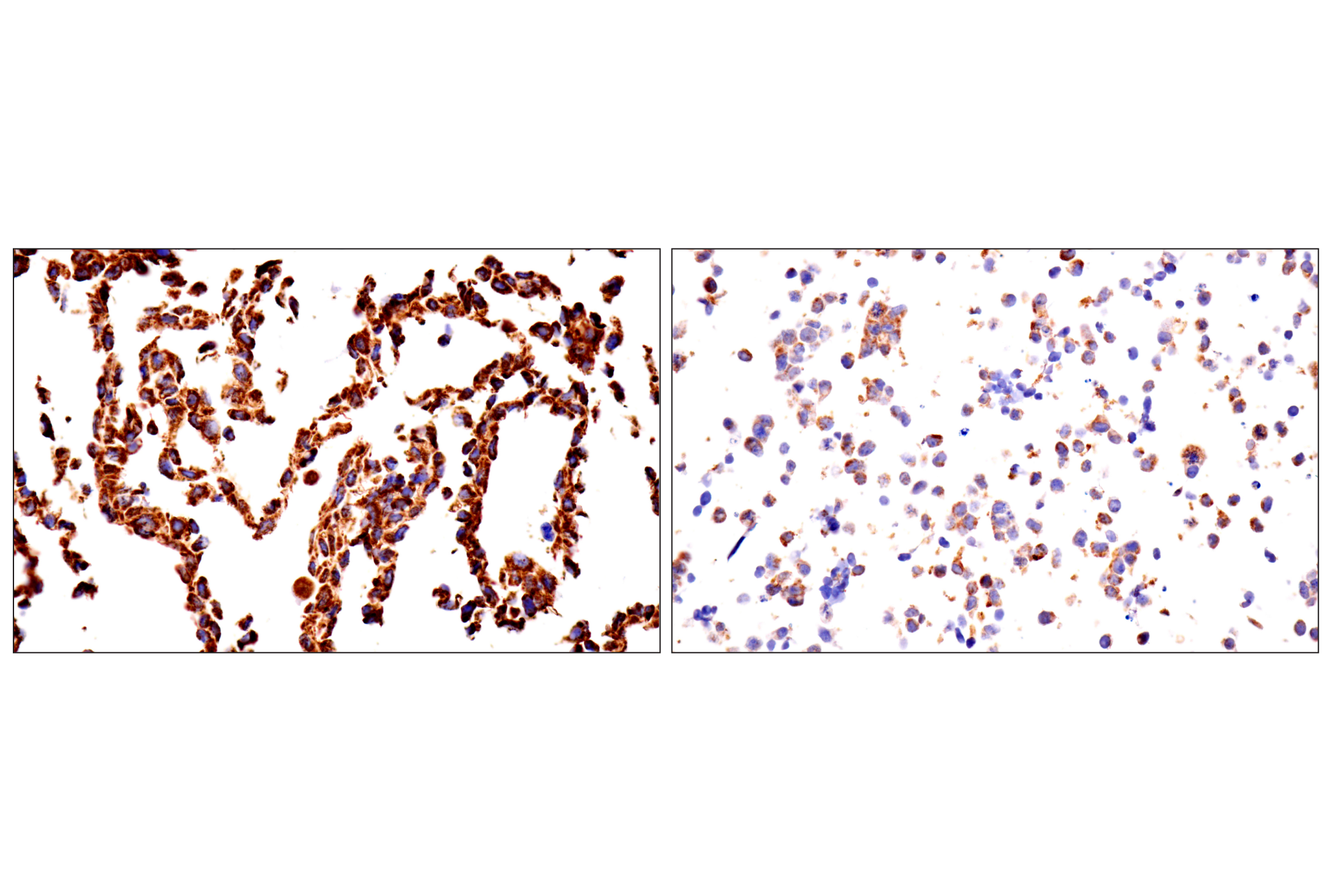Immunohistochemistry Image 14: TSPO (F5B8F) Rabbit mAb