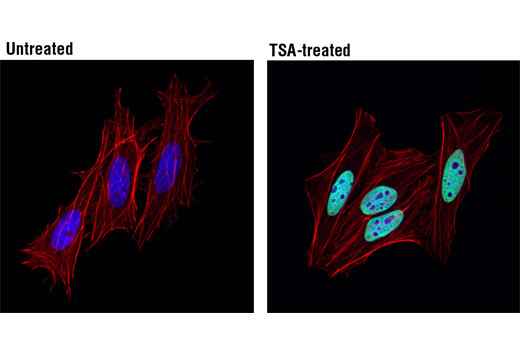 Immunofluorescence Image 1: Acetyl-Histone H2B (Lys5) (D5H1S) XP® Rabbit mAb (BSA and Azide Free)