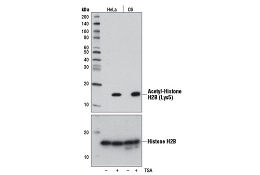 Western Blotting Image 1: Acetyl-Histone H2B (Lys5) (D5H1S) XP® Rabbit mAb (BSA and Azide Free)