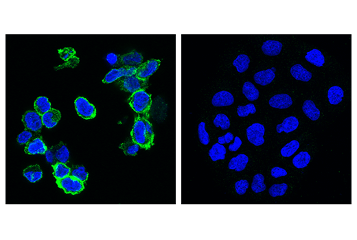 Immunofluorescence Image 2: TIGIT (E5Y1W) XP® Rabbit mAb