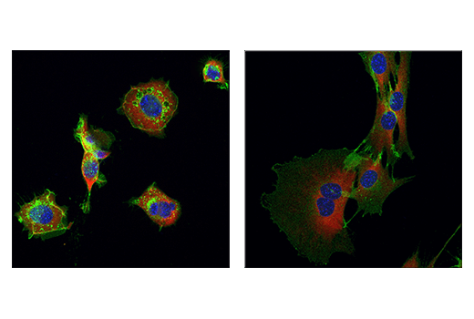 Immunofluorescence Image 3: NCAM1 (CD56) (E7X9M) XP® Rabbit mAb