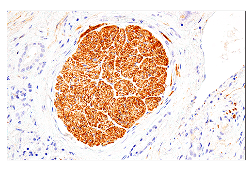 Immunohistochemistry Image 1: NCAM1 (CD56) (E7X9M) XP® Rabbit mAb
