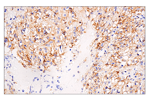 Immunohistochemistry Image 5: NCAM1 (CD56) (E7X9M) XP® Rabbit mAb