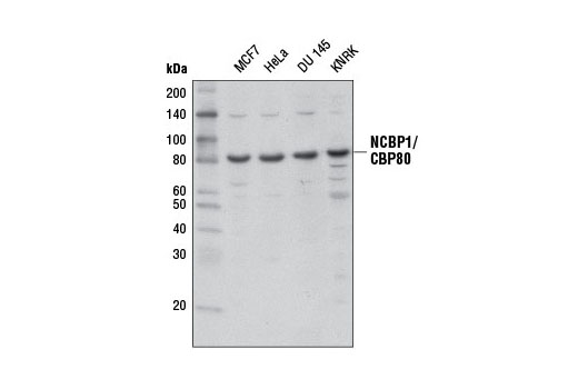 Western Blotting Image 1: NCBP1/CBP80 Antibody