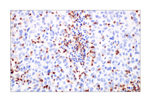 Immunohistochemistry Image 5: CD2 (D6V9F) Rabbit mAb