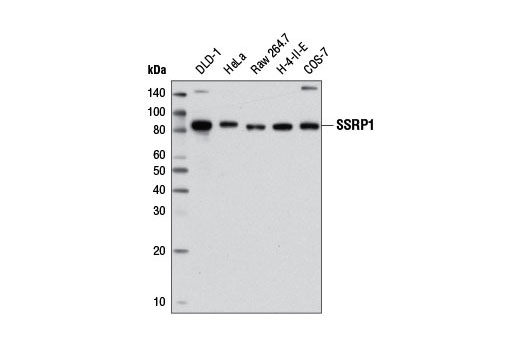 Western Blotting