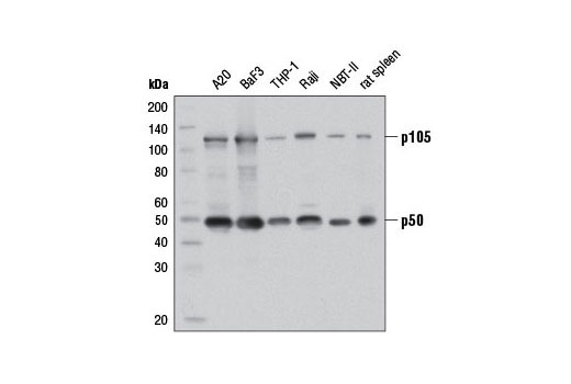 Western Blotting