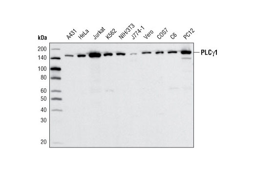 Western Blotting
