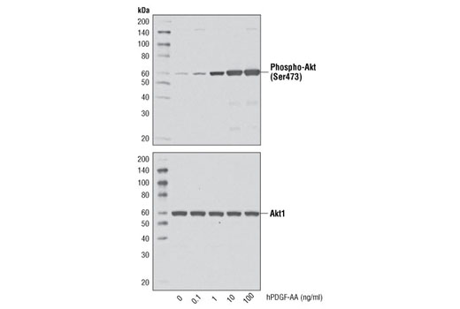 Western Blotting