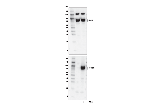 Western Blotting
