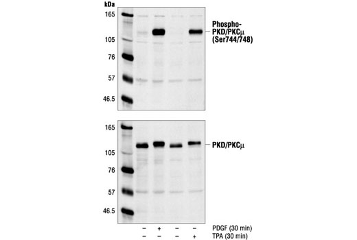 Western Blotting