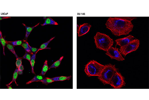 androgen receptor (d6f11) xp03 rabbit mab (alexa fluor03 488