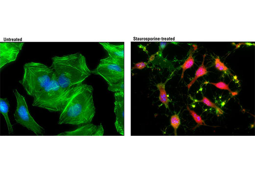 cleaved caspase-3 (asp175) (d3e9) rabbit mab (alexa fluor 594