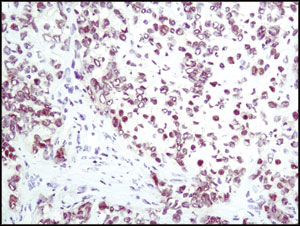 IHC-F (frozen)