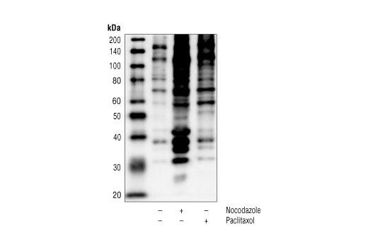 Western Blotting