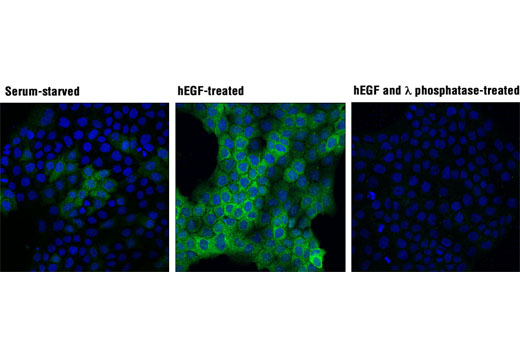 血清飢餓 (左) およびhEGF処理 (100 ng/mLで15分、右) したA-431細胞を、Phospho-p90RSK (Thr359) (D1E9) (緑) を用いて免疫細胞化学染色し、共焦点顕微鏡で観察しました。DRAQ5 (蛍光DNA色素) は青の疑似カラーで示しています。