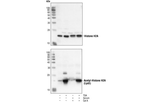 Western Blotting