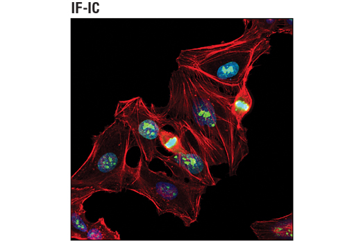 IF-IC