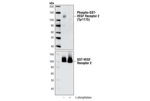 Western Blotting