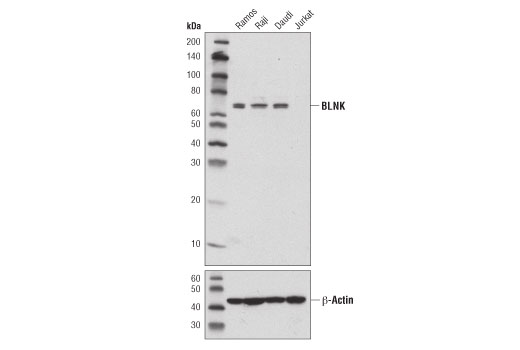 Western Blotting