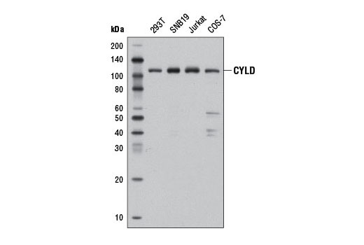 Western Blotting
