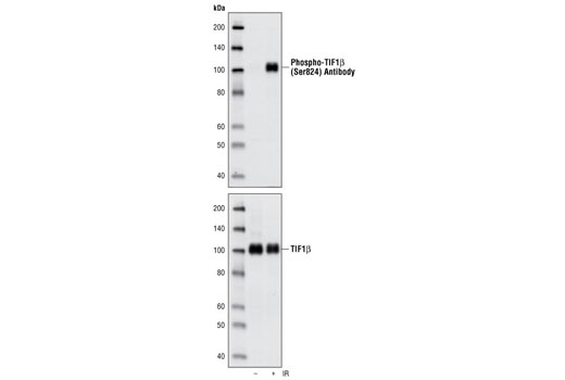 Western Blotting