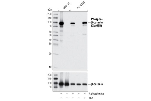 Western Blotting