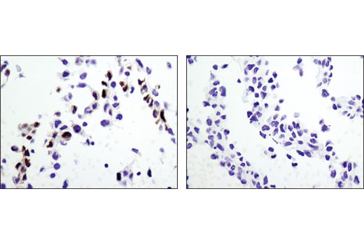 パラフィン包埋した野生型MEF (左) またはRKIPノックアウトMEF (右) の細胞ペレットを、RKIP (D42F3) Rabbit mAbを用いて免疫組織化学染色で解析しました。MEFは、シカゴ大学のMarsha Rosner博士のご厚意により提供いただきました。