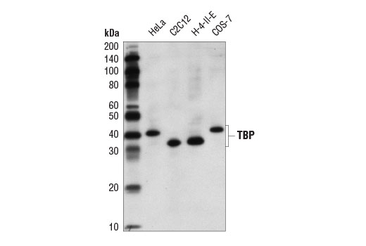 Western Blotting