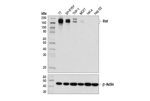 Western Blotting