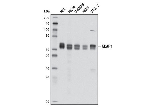 Western Blotting